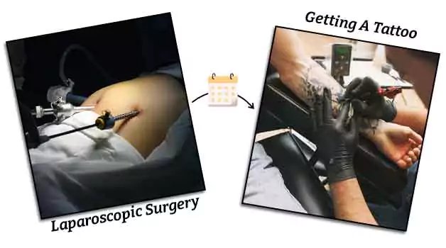 Time after laparoscopic surgery you can get a tattoo