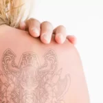 How Long after a sunburn can you get a tattoo