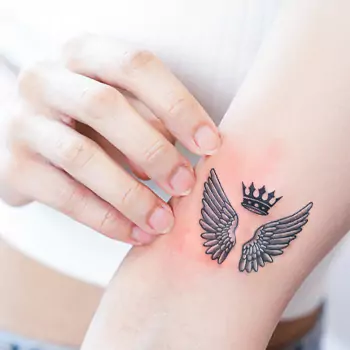 Irritation and itching