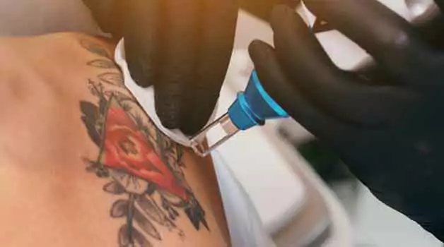 Is red tattoo ink hard to remove