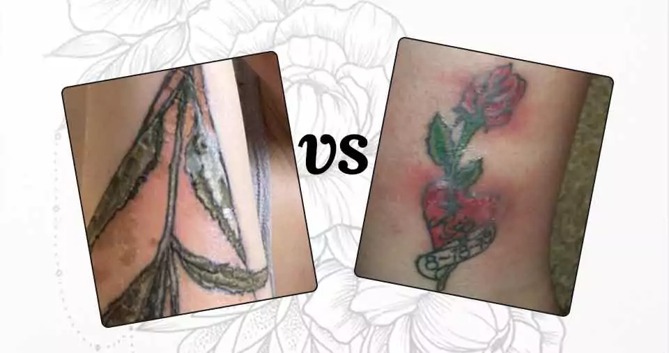 Normal tattoo scabbing vs infection