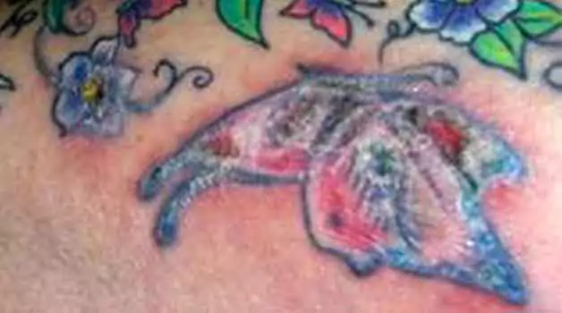 Tattoo infection Understanding the signs and what you should do