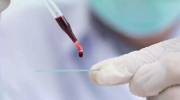 Understanding blood thickness