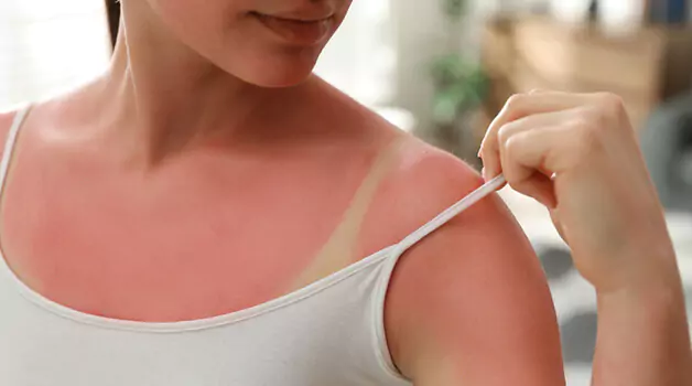 understanding-sunbrun