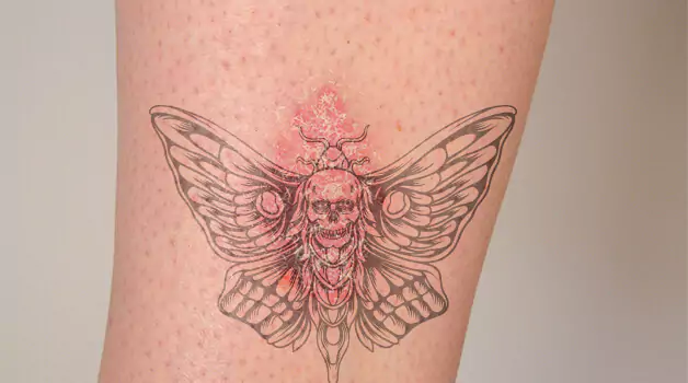 Dangers of tattoo ink from tattoo kits on real skin