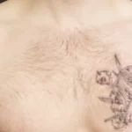 How to reduce swelling on tattoo