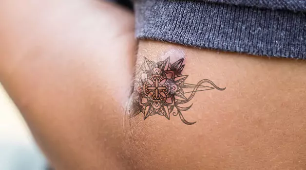 Keloid-after-tattoo-can-you-prevent-it-or-not