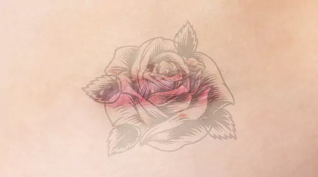 Possibility of getting a tattoo with keloid skin