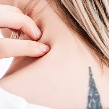 Resist the itch to scratch