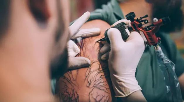 Tattooing considerations for keloid skin