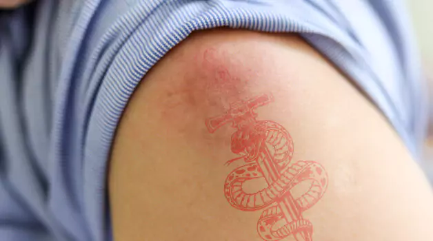 Dealing-with-side-effects-of-red-ink-tattoo-5-effective-tips