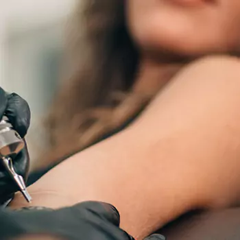 Skin-suitability-and-limitations