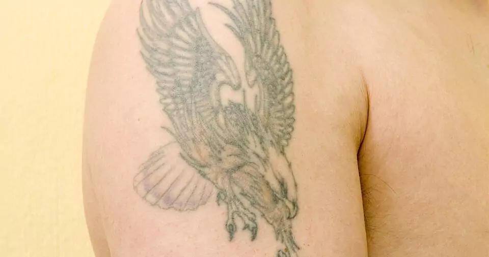 Can tegaderm ruin a tattoo