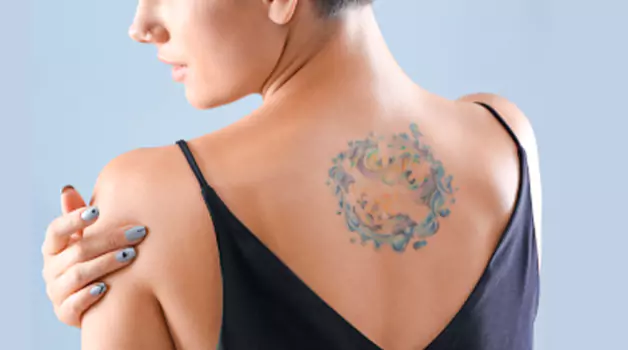 Can you put saniderm on a scabbed tattoo.