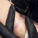 Can you tattoo over freckles