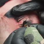 Can you tattoo over nexplanon