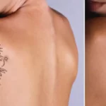 Do tattoos lighten as they heal