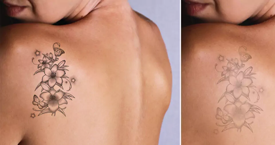 Do tattoos lighten as they heal