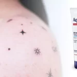 Does aquaphor cause pimples on new tattoos