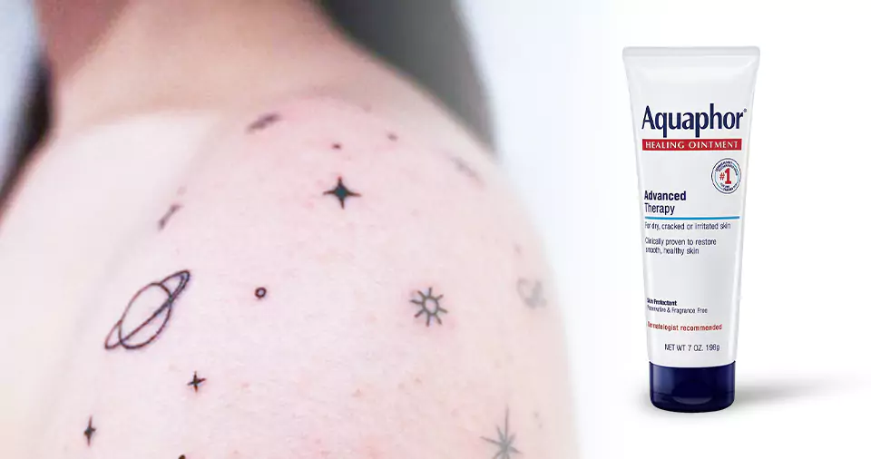 Does aquaphor cause pimples on new tattoos