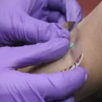 Does tegaderm work for tattoos