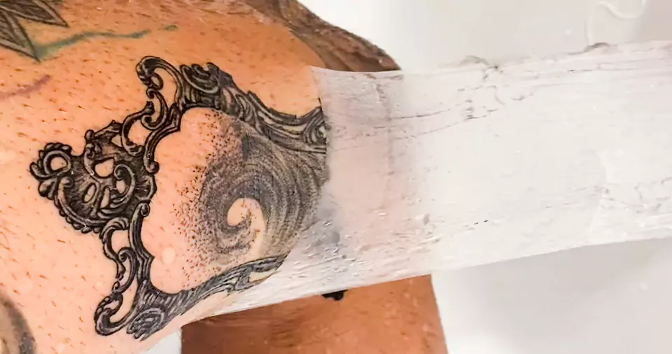 How to get saniderm residue off tattoo