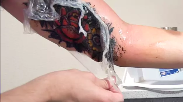 Step by step guide on removing saniderm from a tattoo