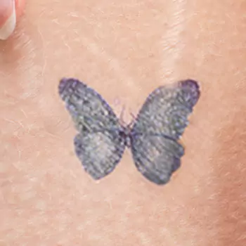 Stretch mark on the tattoo