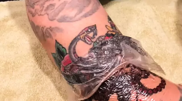 Understanding saniderm residue