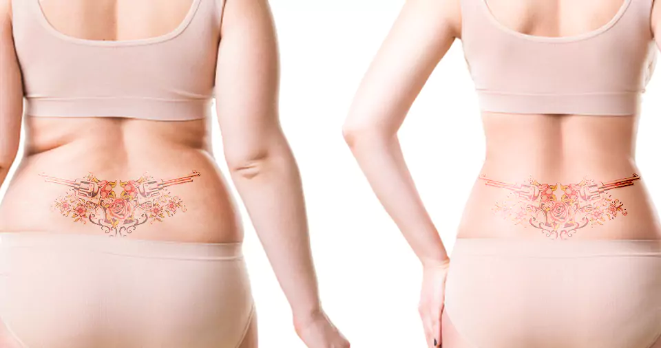 What happens to a tattoo when you lose weight