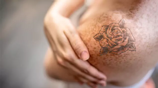 Can you get tattoo over freckles or not