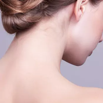 thin-skin-on-the-neck