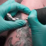 Accidentally Ripped Off Tattoo Scab