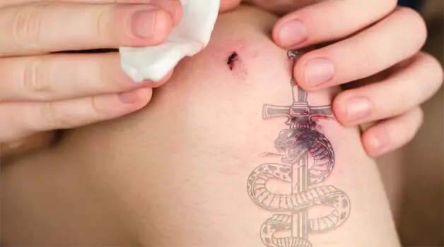 Accidentally Ripped Off Tattoo Scab: Things to Do Afterword