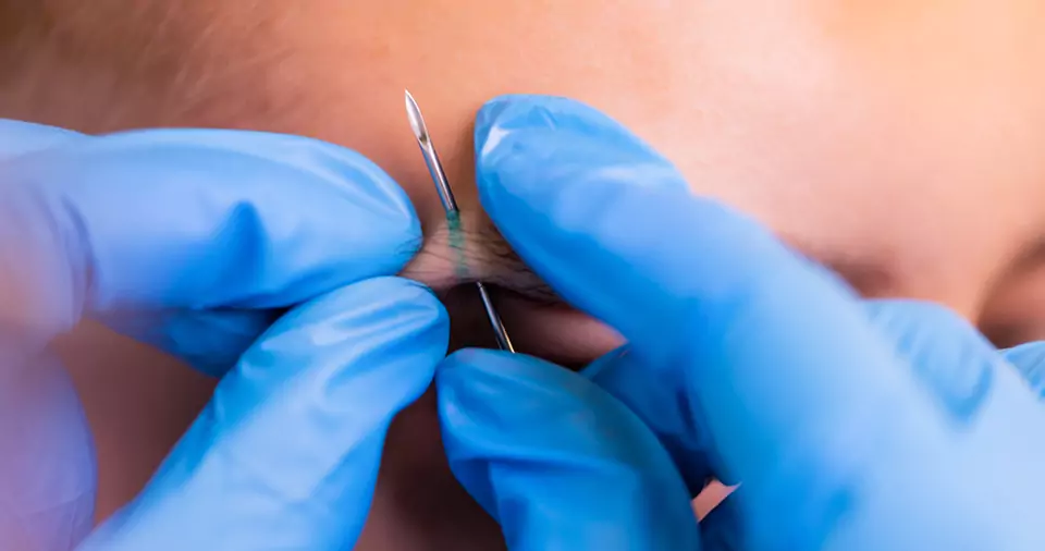 Does a eyebrow piercing hurt