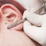 How to take out a tragus piercing