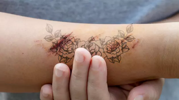 Issues Regarding Scabs Falling Off & Raw Skin Underneath Showing