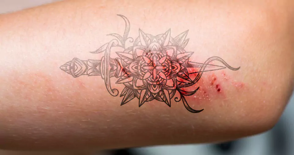 Tattoo Scab Fell Off Raw Skin Underneath