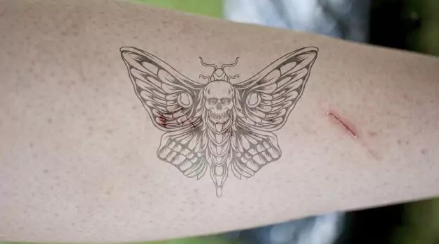 Things To Do If Scabs Fall Off & Raw Skin Underneath Is Exposed