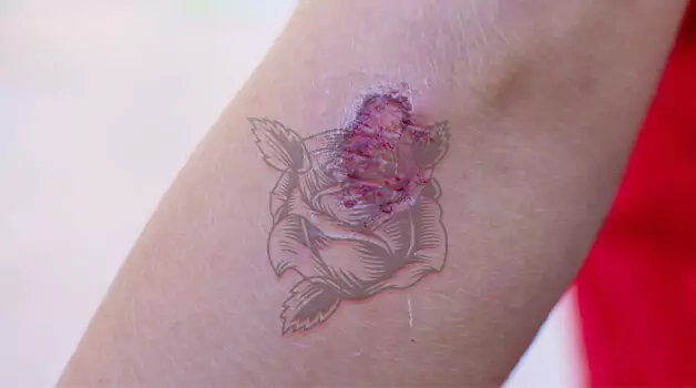 Understanding Tattoo Scabs