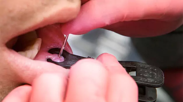 7 reasons why lip piercing embedding happens