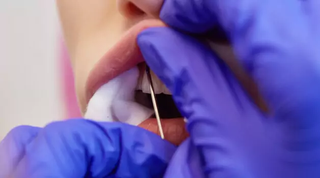 9 things to do if lip piercing embedding happens