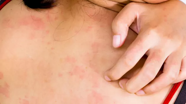 understanding-sensitive-skin