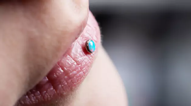 5 ways to stop lip piercing embedding