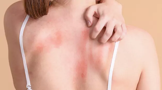 when-not-to-get-a-tattoo-if-you-have-sensitive-skin