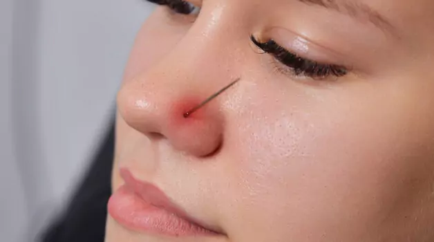 The Healing Process After Having Septum Piercing